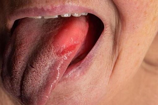 best oral cancer doctor in navi mumbai