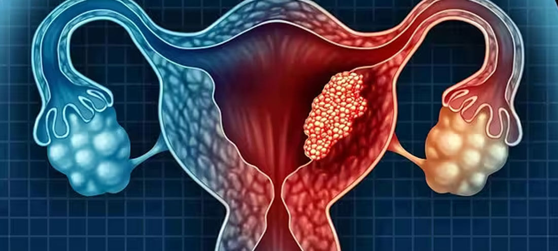 Gastrointestinal Cancer